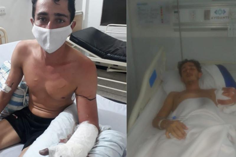 Joven llegó con fractura de brazo a hospital, y terminaron amputándoselo en Ibagué, ¡casi muere!